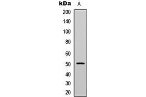 Western blot analysis of CaMK2 alpha/delta (pT286) expression in HeLa (A) whole cell lysates. (CaMK2 alpha/delta 抗体  (pSer286))
