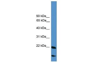 WB Suggested Anti-RBM18 Antibody Titration:  0. (RBM18 抗体  (Middle Region))
