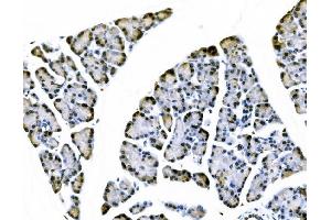IHC analysis of Elongin-C/ELOC using anti-Elongin-C/ELOC antibody (ABIN7598951).
