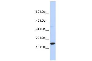 TPD52L3 antibody used at 1 ug/ml to detect target protein.