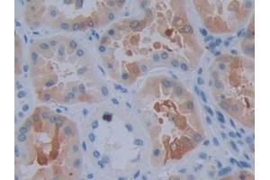 Immunohistochemistry (IHC) image for anti-Crystallin, alpha B (CRYAB) (AA 1-175) antibody (ABIN7435256)