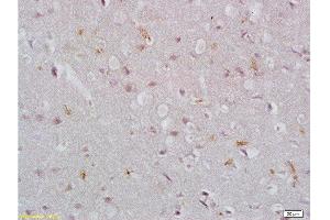 Formalin-fixed and paraffin embedded rat brain tissue labeled with Rabbit Anti-EpCAM/CD326 Polyclonal Antibody , Unconjugated at 1:200 followed by conjugation to the secondary antibody and DAB staining.