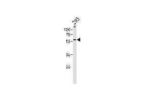 Western Blotting (WB) image for anti-Zinc Finger Protein 76 (Expressed in Testis) (ZNF76) (AA 388-415), (C-Term) antibody (ABIN1882035)