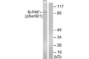 Immunohistochemistry analysis of paraffin-embedded human placenta tissue using B-Raf (Phospho-Ser602) antibody. (SNRPE 抗体  (pSer602))
