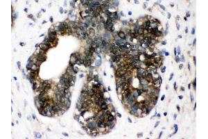 Immunohistochemistry (IHC) image for anti-Chaperonin Containing TCP1, Subunit 4 (Delta) (CCT4) (AA 452-539) antibody (ABIN4886514)