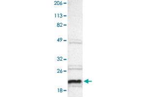Western blot analysis of Human cell line RT-4 with ALG13 polyclonal antibody . (ALG13 抗体)
