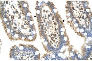 Human Intestine (C8B 抗体  (Middle Region))