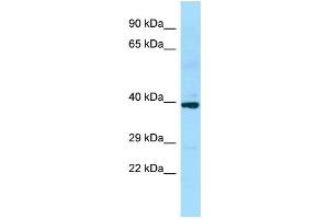WB Suggested Anti-SLC35D2 Antibody Titration: 1. (Solute Carrier Family 35 (UDP-GlcNAc/UDP-Glucose Transporter), Member D2 (SLC35D2) (C-Term) 抗体)