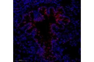 Immunofluorescence (Paraffin-embedded Sections) (IF (p)) image for anti-Notch 3 (NOTCH3) antibody (ABIN7074862)