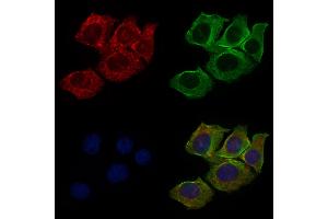 ABIN6265513 and ABIN6276479 staining HepG2 cells by IF/ICC. (TDGF1 抗体  (Internal Region))