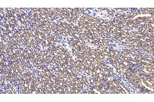Detection of LY96 in Mouse Kidney Tissue using Polyclonal Antibody to Lymphocyte Antigen 96 (LY96) (LY96 抗体  (AA 16-160))