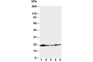 Western blot testing of Caveolin-1 antibody and Lane 1:  U87 (Caveolin-1 抗体  (C-Term))