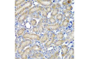 Immunohistochemistry of paraffin-embedded rat kidney using PDCD6 antibody at dilution of 1:200 (40x lens). (PDCD6 抗体)