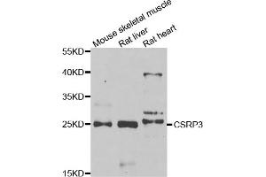 Western blot analysis of extracts of various cell lines, using CSRP3 antibody. (CSRP3 抗体)