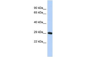 WB Suggested Anti-ZNF524 Antibody Titration:  0. (ZNF524 抗体  (N-Term))