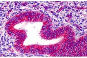 Human Uterus: Formalin-Fixed, Paraffin-Embedded (FFPE) (HMGCS1 抗体  (AA 251-300))