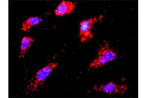 Proximity Ligation Analysis of protein-protein interactions between TP53 and CSNK1E. (CK1 epsilon 抗体  (AA 2-100))