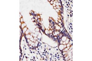 (ABIN6243813 and ABIN6577796) staining CHST12 in Human small intestine tissue sections by Immunohistochemistry (IHC-P - paraformaldehyde-fixed, paraffin-embedded sections). (CHST12 抗体  (N-Term))