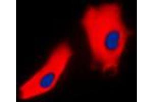 Immunofluorescent analysis of Gamma-catenin staining in A431 cells. (JUP 抗体  (C-Term))