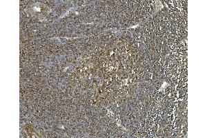 IHC analysis of Hsc70 using anti-Hsc70 antibody (ABIN7601962). (Hsc70 抗体  (AA 520-614))