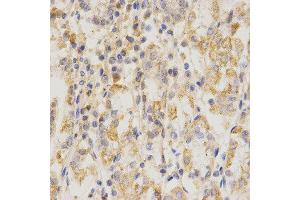 Immunohistochemistry (IHC) image for anti-CD151 (CD151) antibody (ABIN1871589)