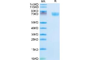 SDS-PAGE (SDS) image for Complement Factor D (CFD) (AA 26-259) protein (Fc Tag) (ABIN7274336)