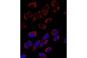 Confocal immunofluorescence analysis of U2OS cells using MRPS31 Polyclonal Antibody (ABIN6133059, ABIN6144045, ABIN6144046 and ABIN6216735) at dilution of 1:200. (MRPS31 抗体  (AA 66-395))