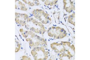 Immunohistochemistry of paraffin-embedded human stomach using RCN2 antibody (ABIN5975169) at dilution of 1/100 (40x lens). (RCN2 抗体)