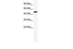 Image no. 1 for anti-Zinc Finger Protein 239 (ZNF239) (AA 41-90) antibody (ABIN6735993) (ZNF239 抗体  (AA 41-90))