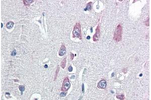 Human Brain, Cortex (formalin-fixed, paraffin-embedded) stained with VPS25 antibody ABIN337136 at 5 ug/ml followed by biotinylated goat anti-rabbit IgG secondary antibody ABIN481713, alkaline phosphatase-streptavidin and chromogen. (VPS25 抗体  (N-Term))