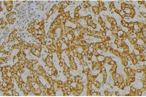 ABIN6276546 at 1/100 staining Mouse liver tissue by IHC-P. (SH2D1A 抗体  (Internal Region))