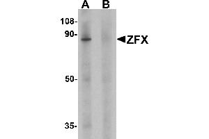 Western blot analysis of ZFX human small intestine tissue lysate with ZFX antibody at 1 µg/mL in (A) the absence and (B) the presence of blocking peptide. (ZFX 抗体  (C-Term))