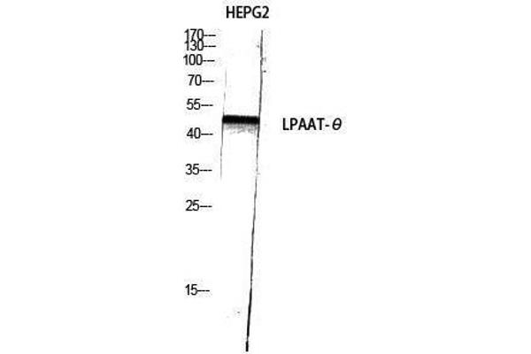 AGPAT9 抗体  (C-Term)