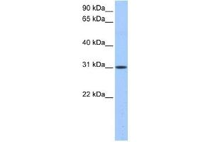 HUS1B antibody used at 0. (HUS1B 抗体)