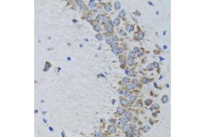 Immunohistochemistry of paraffin-embedded rat brain using PTPN1 antibody (ABIN1980139) at dilution of 1:100 (40x lens). (PTPN1 抗体)
