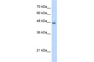 WB Suggested Anti-KYNU Antibody Titration:  5. (KYNU 抗体  (N-Term))