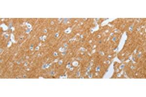 Immunohistochemistry of paraffin-embedded Human brain tissue using SLC17A7 Polyclonal Antibody at dilution of 1:200(x200)