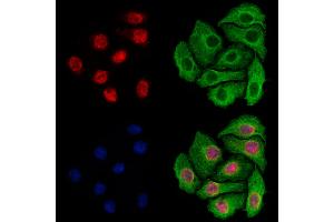 ABIN7094839 and ABIN7098890 staining Hela cells by IF/ICC.