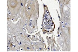 IHC analysis of GSDMD using anti-GSDMD antibody (ABIN7599432).