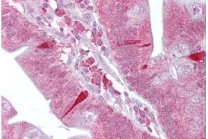 Immunohistochemistry (IHC) image for anti-Activating Transcription Factor 4 (Tax-Responsive Enhancer Element B67) (ATF4) (N-Term) antibody (ABIN6748573)