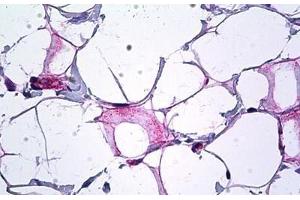 Human Breast, Collagen: Formalin-Fixed, Paraffin-Embedded (FFPE) (COL18A1 抗体  (AA 801-850))