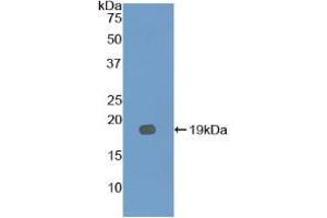 Western blot analysis of recombinant Mouse IL12Rb2. (IL12RB2 抗体  (AA 285-441))