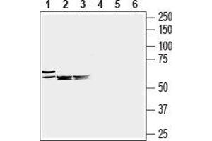 Western blot analysis of mouse heart (lanes 1 and 4), mouse brain (lanes 2 and 5) and rat brain (lanes 3 and 6) lysates: - 1-3. (SLC6A8 抗体  (C-Term, Extracellular))