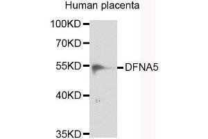 Western blot analysis of extracts of human placenta, using DFNA5 antibody. (DFNA5 抗体)