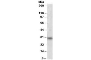Western blot testing of human skeletal muscle lysate with FHL3 antibody at 1ug/ml. (FHL3 抗体)
