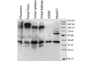 Western Blotting (WB) image for anti-Placenta-Specific 1 (PLAC1) antibody (ABIN1855659)