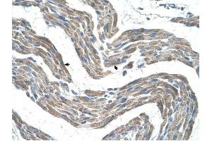 GPR161 antibody was used for immunohistochemistry at a concentration of 4-8 ug/ml to stain Skeletal muscle cells (arrows) in Human Muscle. (GPR161 抗体  (C-Term))