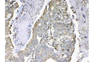 Immunohistochemistry (IHC) image for anti-Cyclophilin B (PPIB) (AA 158-216) antibody (ABIN5519055)