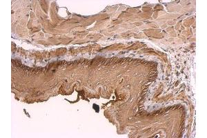 IHC-P Image KIDINS220 antibody [C3], C-term detects KIDINS220 protein at membrane on mouse esophagus by immunohistochemical analysis. (KIDINS220 抗体  (C-Term))