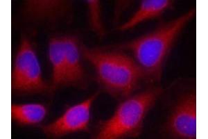 Immunofluorescence staining of methanol-fixed Hela cells using VASP(Ab-157) Antibody. (VASP 抗体)